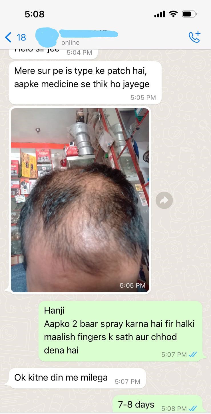 ALOPECIA-AREATA-SPRAY_3