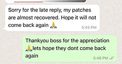 alopecia review_2