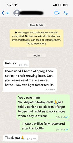 alopecia areata review