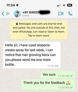 alopecia review (1)
