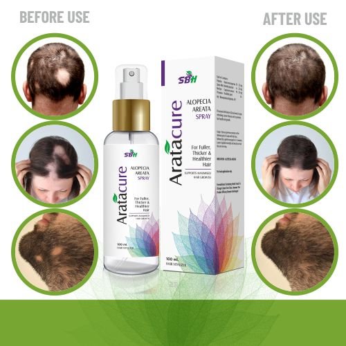 SBH Alopecia Areata spray Medicine