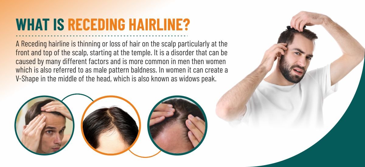 SBH Alopecia Areata spray Medicine