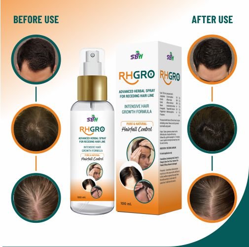SBH Alopecia Areata spray Medicine